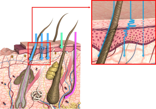 ABSORCION PERCUTANEA