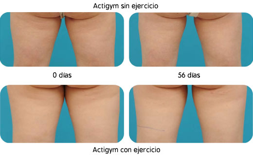 Actigym