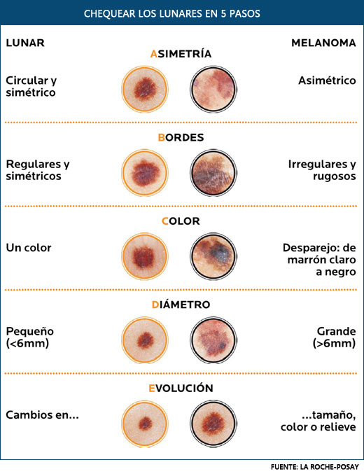 MELANOMA