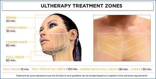 Ultherapy