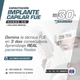 Asistente en Implante Capilar FUE